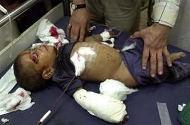 photo: a young boy severely injured in Fallujah