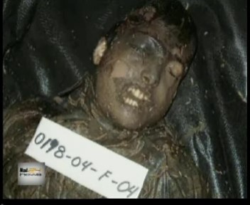 a boy, dead, with skin burned black